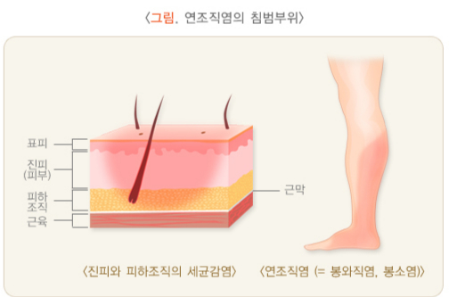 /자료=국가건강정보포털